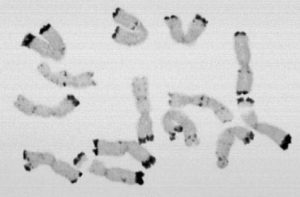 Plant Chromosomes